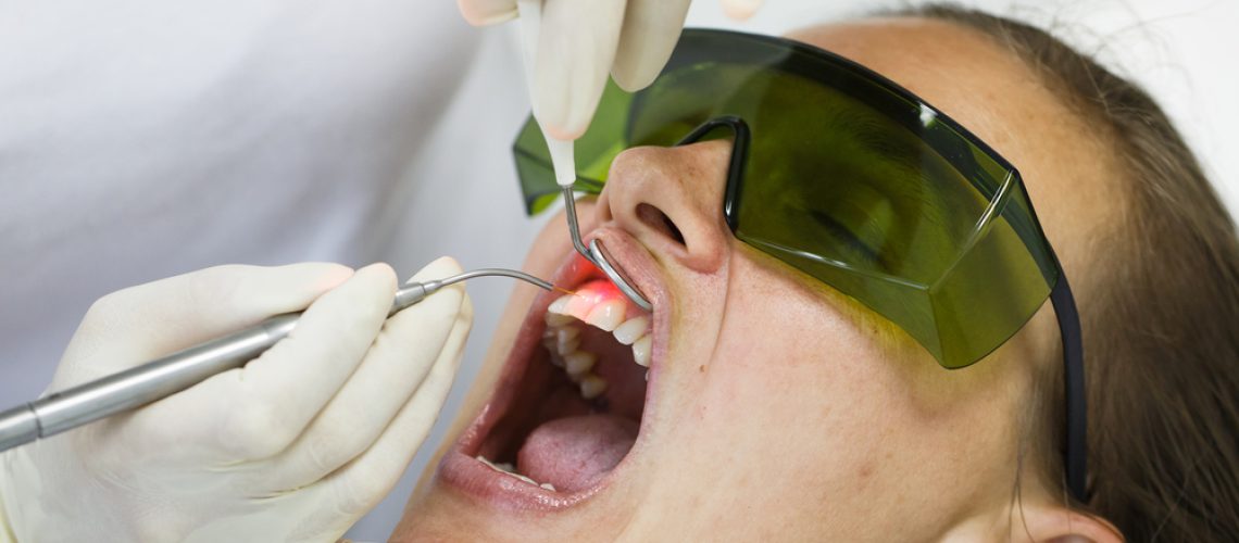 LANAP® Gum Disease Treatment: What to Expect