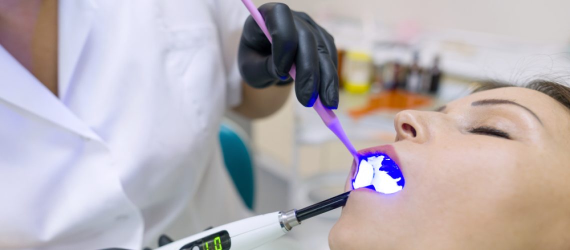 Recovery after LANAP® Procedure